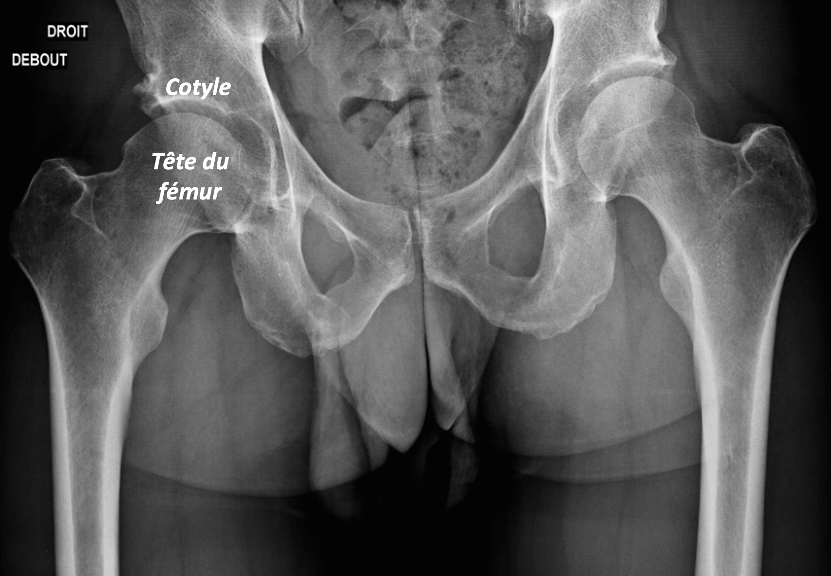 Anatomie de la hanche